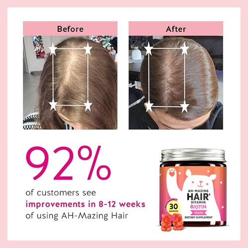 Matovia Biotin Hair Revival Gummies