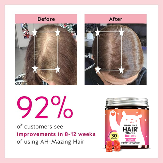 Matovia Biotin Hair Revival Gummies